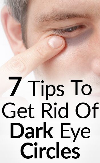 7 Tips To Get Rid Of Black Under The Eyes Black Under Eyes Get Rid Of, How To Get Rid Of Black Under Eyes, How To Get Rid Of Black Circles Eye, Black Under Eyes, Black Under Eye, Black Circles Under Eyes, Men's Hygiene, Eye Stye Remedies, Julia Gomes