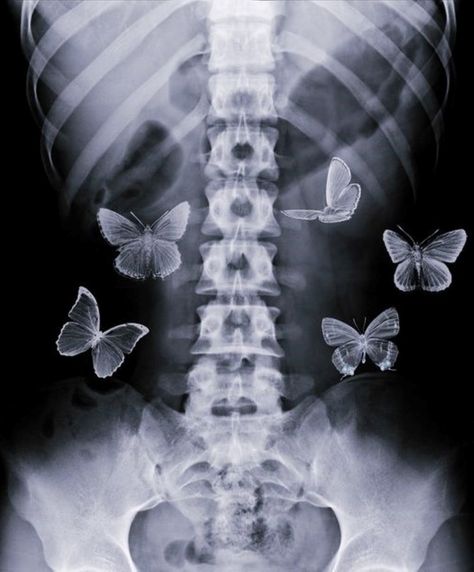 Xray Art, Wallpaper Estetika, Butterflies In My Stomach, Arte Grunge, Butterfly Poster, Aesthetic Grunge, Couple Aesthetic, Vintage Movies, Grunge Aesthetic