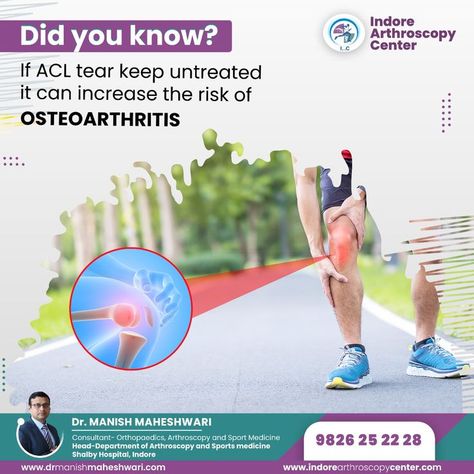 #acltear #aclrecovery #kneeinjury #osteoarthritis #orthopaedic  #indorearthroscopycenter Arthroscopic Knee Surgery, Acl Reconstruction Surgery, Rotator Cuff Surgery, Shoulder Dislocation, Acl Tear, Knee Replacement Surgery, Shoulder Surgery, Frozen Shoulder, Orthopedic Surgery