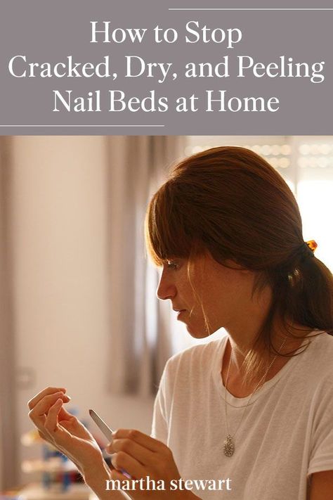 A nail care expert shared everything there is to know about peeling cuticles that bleed, crack, and are dry any time of the year. Plus, how to prevent them once and for all and help keep your nails growing and strong. #marthastewart #lifestyle #beautytips #hairstyles Peeling Fingernails, Peeling Cuticles, Hand Care Routine, Nail Remedies, Healthy Cuticles, Cracked Nails, Peeling Nails, Dry Cuticles, Nail Soak