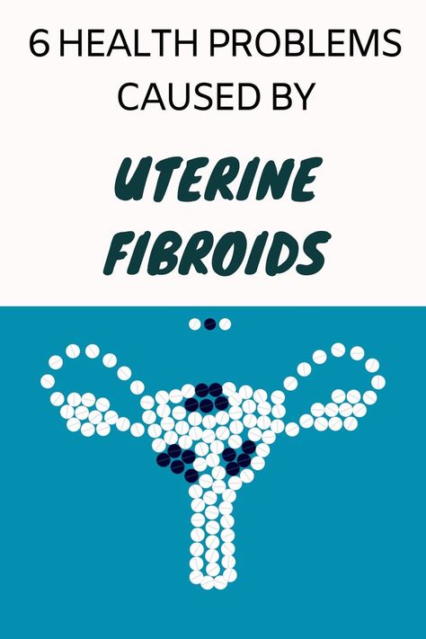 uterine fibroids Fibroid Diet, Fibroid Uterus, Fibroid Surgery, Fibroid Tumors, S Alphabet, Environmental Factors, Daily Health Tips, Fitness Advice, Good Health Tips