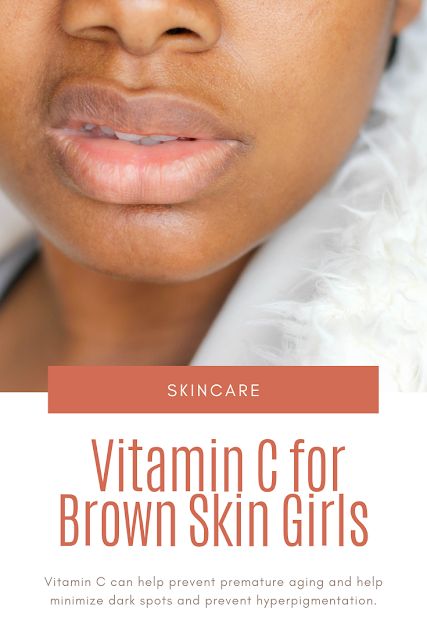 Vitamin C for Brown Skin Girls | Sisterlocked Skincare Brown Skin, Skincare For Brown Skin, Vitamin C Oil For Skin, Vitamin C Oil For Face Benefits, Skin Care For Brown Skin, Clear Brown Skin, Vitamin C For Face, Antioxidants Benefits Skin, Vitamin C For Skin