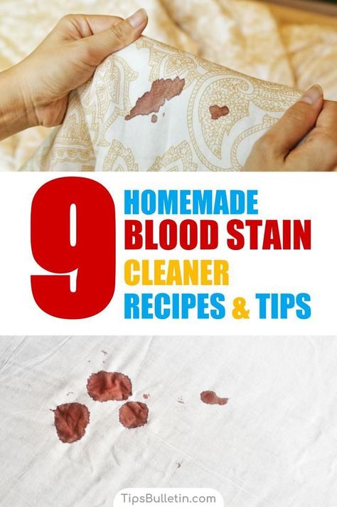 Discover tips for how to get blood out of clothes with these awesome life hacks. Learn how to get blood out of fabric fast with these simple cleaning tips using hydrogen peroxide, baking soda, and other everyday products. Remove blood stains from fabrics fast. #getbloodout #periodstains #bloodstains How To Remove Blood From Fabric, Get Blood Out Of Sheets, Blood Removal From Clothes, Remove Blood Stains From Clothes, Removing Blood Stains From Clothes, How To Remove Blood Stains From Clothing, How To Get Blood Out Of Clothes, Get Blood Out Of Clothes, Blood Out Of Clothes