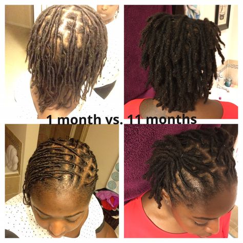 1 month vs. 11 months I started with very fine hair and my tresses have thickened up thanks to the loc process Starter Locs On Fine Hair, Locs Fine Hair, Fine Hair Locs, Locs On Fine Hair, Find Hairstyles, Tapered Hair, Haute Hair, Ethnic Hairstyles, Short Locs Hairstyles