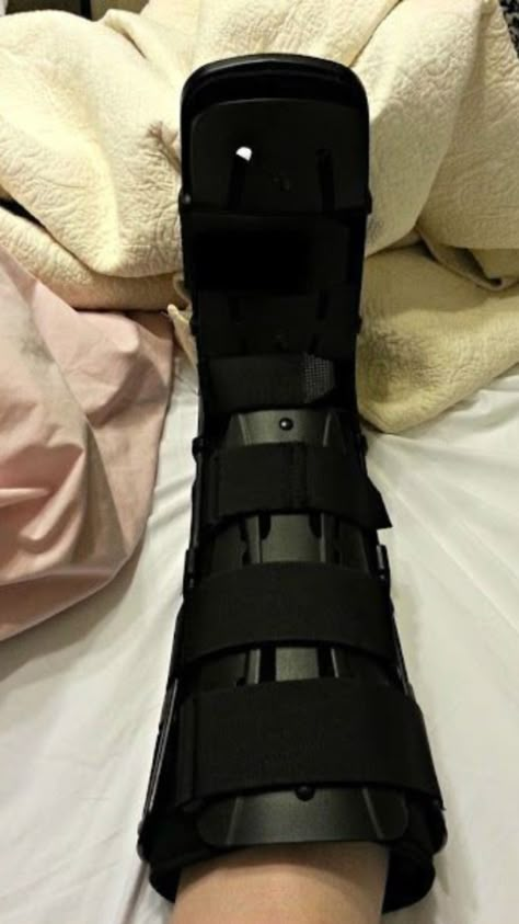 Sprained Leg, Ankle Surgery Recovery, Broken Ankle Recovery, Walking Cast, Broken Foot, Ankle Surgery, Hospital Photography, Broken Ankle, Kinesiology Taping