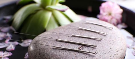 Does complementary and alternative medicine help women improve fertility? ESME writer Sarah Kowalski weighs the pros and cons… Acupuncture Benefits, Acupuncture Needles, Improve Fertility, Holistic Medicine, Deep Tissue Massage, Traditional Chinese Medicine, Skin Issues, Chinese Medicine, Acupressure