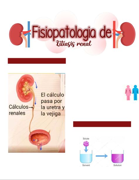 Litiasis Renal - Resumen Patologia Estructural Y Funcional - StuDocu Renal System Anatomy, Renal Anatomy, Renal Calculi Nursing, Renal Calculi, Renal Histology