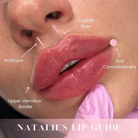 Round Lip Filler, Lip Filler Shape Ideas Pouty, Full Lips Natural, Lip Filler Styles, Russian Lip Filler Technique, Lip Injections Shapes, Russian Keyhole Lips, Russian Lips, Desired Lips