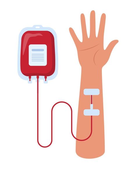 Blood bag and hand of donor or patient. Blood transfusion. Blood donation. Concept vector illustration. Blood Illustration, Backgrand Instagram, Iron Overload, Blood Bag, Donating Blood, Donate Blood, Illustration Advertisement, Bag Illustration, Blood Donor