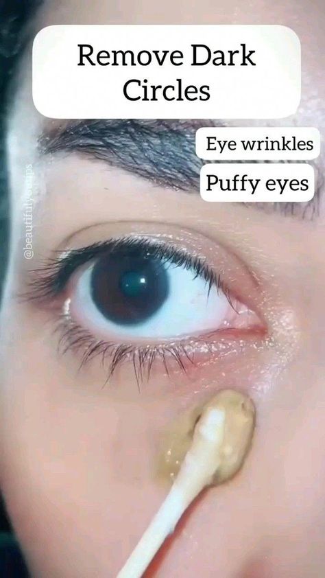 Remove Dark Circles, Beginner Skin Care Routine, Eye Wrinkles, Face Skin Care Routine, Natural Skin Care Remedies, Diy Skin Care Routine, Natural Face Skin Care, Good Skin Tips, Under Eye Wrinkles