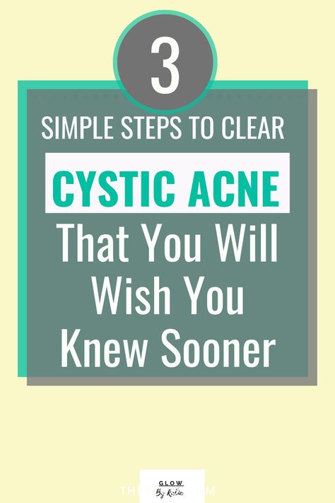 How To Remove Cystic Acne, Foods For Cystic Acne, Acne Elimination Diet, How To Get Rid Of Cystic Acne Overnight, Get Rid Of Cystic Acne Overnight, Natural Remedies For Cystic Acne, Cystic Acne Skin Care Routine, How To Treat Cystic Acne, How To Clear Up Acne Fast