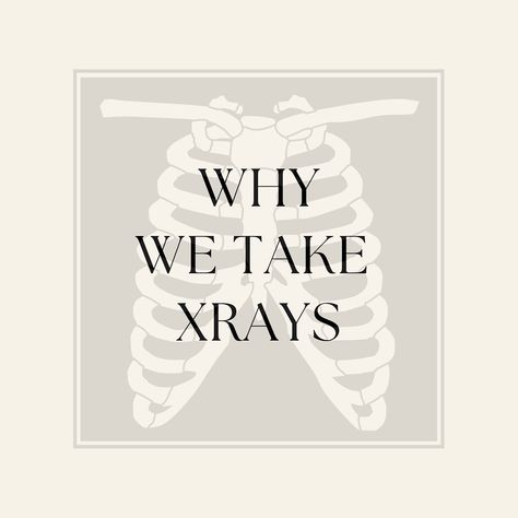 ⚠️WHY WE X-RAY! Our corrective chiropractors use X-rays as part of their diagnostic process for several reasons: 🌟Assessment of Spinal Alignment: X-rays provide detailed images of the spine, allowing chiropractors to assess the alignment of vertebrae, curvature of the spine, and any misalignments (subluxations) that may be present. 🌟Identification of Underlying Issues: X-rays can reveal underlying structural issues such as degenerative changes, fractures, or abnormalities that may contribu... Subluxation Chiropractic, Spinal Alignment, X Rays, Patient Education, Chiropractic Care, Chiropractic, X Ray, Assessment, Education