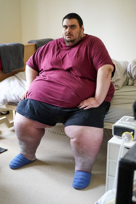 BRITAIN’S fattest man wants a gastric bypass for Christmas – after piling on most of the weight he lost over the past year. Super-morbidly obese Jason Holton was last seen being winched from his old, third-floor flat by crane in 2020 after he ballooned to a terrifying 50st. Jason, 31, managed to lose 10st in […] Whale Costume, Messi Pictures, Chubby Men, Shock And Awe, Disney Princess Movies, Gastric Bypass, Fat Man, Disney Princess Art, Old Men