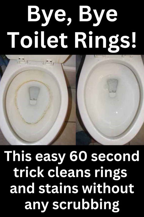 "Lazy Moms" toilet cleaning trick cleans the whole bowl in 60 seconds without any scrubbing at all. Cleaning Toilet Ring, Clean Toilet Bowl Stains, Toilet Bowl Stains, Toilet Cleaning Hacks, Toilet Ring, Easy House Cleaning, Toilet Stains, Diy Tips And Tricks, Clean Toilet Bowl