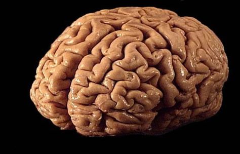 Cerebral Cortex, Daily Lesson Plan, Brain Diseases, The Human Brain, Brain Tricks, Brain Food, Brain Power, Bad Things, Improve Memory