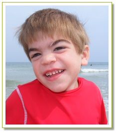 article_image1 Sanfilippo Syndrome, Baby Face, Quick Saves