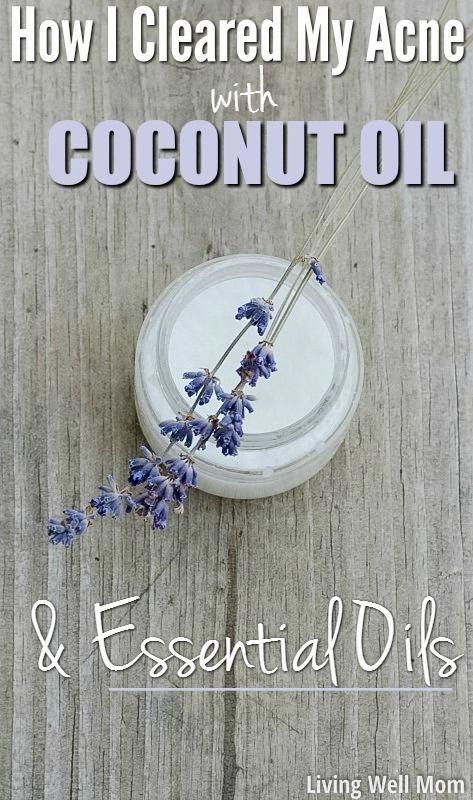 Coconut Oil And Essential Oils, Health Coconut Oil, Diy Coconut Oil, Coconut Oil For Acne, Coconut Oil Skin Care, Skin Care Routine For 20s, Coconut Oil Hair Mask, Coconut Oil For Face, Anti Aging Creme