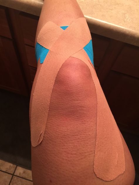 Taping the knee with kinesio tape Knee Taping, Kinesio Tape, Kt Tape, Kinesio Taping, Knee Pain, Kingston, Workout Routine, The Knee, Life Hacks