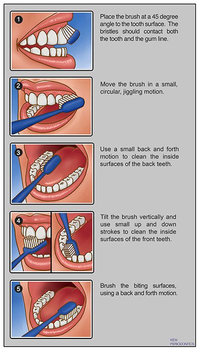 How To Brush Your Teeth, Dental Pictures, Dental Hygiene Student, Dental Photos, Dental Social Media, Dental Posts, Dental Posters, Tooth Brushing, Strong Teeth