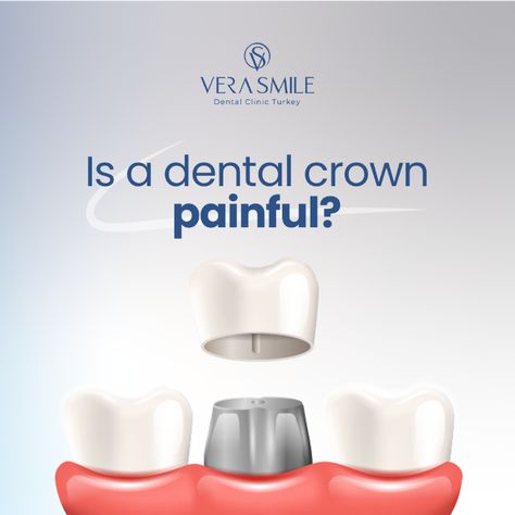 When dental crowns are placed, there is not a great deal of pain.

However, there is a certain amount of discomfort that can be caused after the procedure. This is normal.

During a dental crown placement, the infected areas of the teeth are removed through dental drilling.

Contact us to have a beautiful smile. ✨

Get your free consultation right now!

+90 555 888 81 23 Dental Social Media Posts, Dental Marketing Social Media, Christmas Creatives, Medical Ads, Dentist Social Media, Dental Health Week, Local Anesthesia, Dental Caps, Tooth Crown