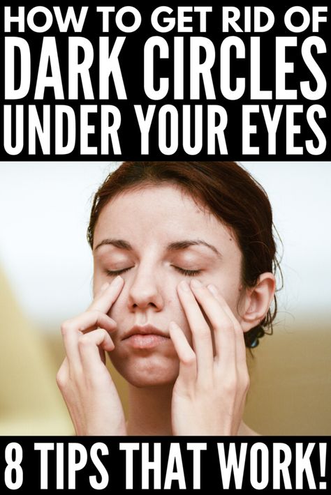 Get Rid Of Eye Bags, Rid Of Eye Bags, Baggy Eyes, Remove Eye Bags, Dark Eye Circles, Under Eyes, Dark Circles Under Eyes, Dark Under Eye, Diy Remedies