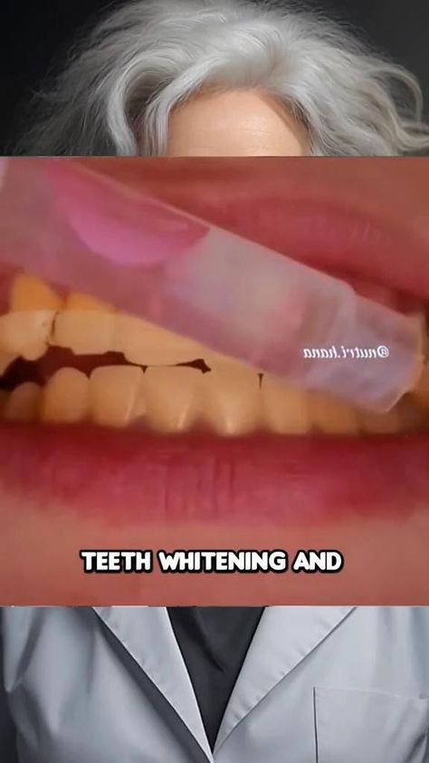 #Teeth_Care_Routine #Beginner_Skin_Care_Routine #Face_Skin_Care_Routine #Teeth_Whitening_Diy Teeth Care Routine, Teeth Whitening At Home, Beginner Skin Care Routine, Teeth Whitening Diy, Skin Care Basics, Natural Face Skin Care, Basic Skin Care, Diy Skin Care Routine, Face Skin Care Routine