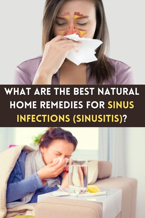 Sinus Symptoms, Sinus Infection Relief, Sinus Infection Symptoms, Sinus Inflammation, Home Remedies For Sinus, Sinus Health, Sinus Infection Remedies, Common Diseases, Sinus Pain