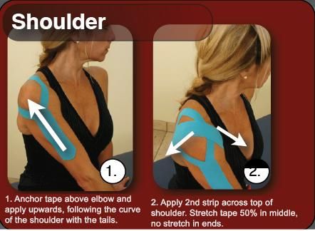 Worth a try Kinesiology Taping For Ribs, Shoulder Kinesio Taping, Kinesiology Tape Shoulder, Kinesio Taping Shoulder, Kt Tape For Severs Disease, K Tape, Rotator Cuff Injury, Sports Tape, Kinesio Taping