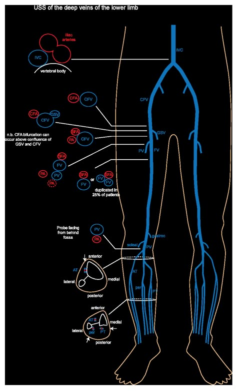 DVT and lower limb ultrasound - EchoPraxis Cath Lab Nursing, Diagnostic Medical Sonography Student, Ultrasound School, Arteries Anatomy, Cardiac Sonography, Vascular Ultrasound, Sonography Student, Ultrasound Sonography, Radiology Student