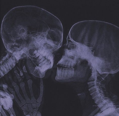 Pjo Dr, Amir Tataloo, Skeleton Couple, Blurry Pictures, Couple Wallpaper, Couple Pictures, Dark Aesthetic, Art Inspo, Aesthetic Wallpapers