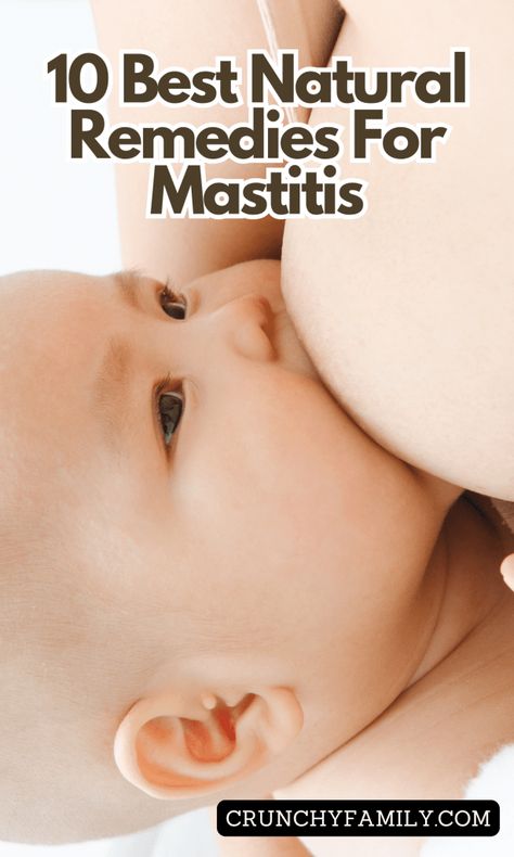 How to help clear mastitis naturally, the best natural remedies for mastitis and clogged milk ducts, to help your nursing journey go smoothly Mastitis Remedies At Home, Clogged Milk Duct Remedies, Mastitis Remedies, Natural Health Remedies, Natural Wellness, Health Remedies, Natural Health, My Daughter, Home Remedies