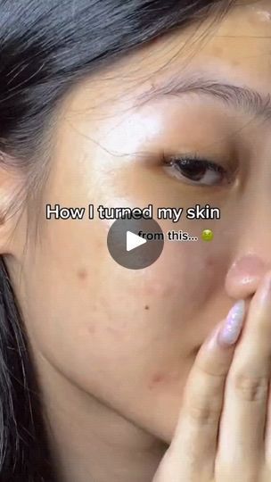 Isabel Larosa, Turmeric Powder, Glowing Skincare, Acne Free, Glow Up Tips, Bright Skin, Anti Acne, Homemade Skin Care, Rice Flour