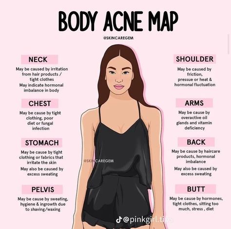 How To Pop Pimples, Body Acne Map, Acne Map, Clear Glass Skin, Selfcare Routine, Skin Facts, Selfcare Skincare, Skin Advice, Body Acne