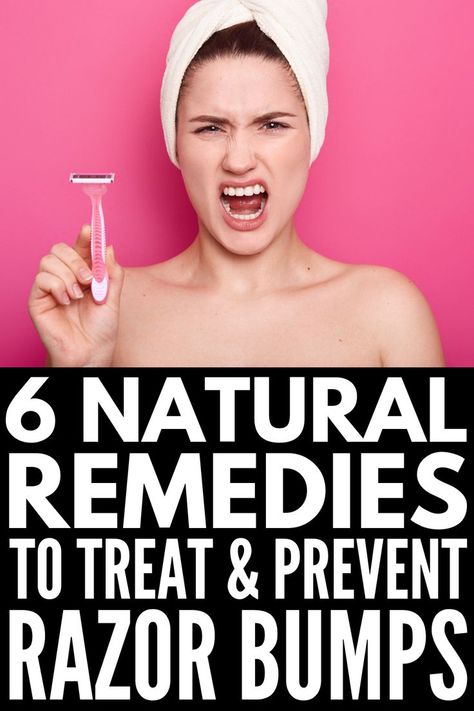 Razor Burn Remedies, Razor Bumps Remedy, Burn Remedy, Ingrown Hair Removal, Skin Bumps, Shaving Tips, Razor Burn, Natural Skin Care Remedies, Razor Bumps