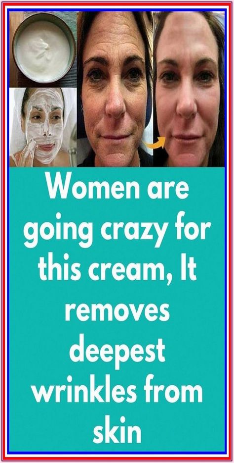 YOU NEED ONLY 2 INGREDIENTS TO ELIMINATE SAGGING FACIAL SKIN AND WRINKLES OVER NIGHT Wrinkle Remedies, Wrinkle Free Skin, Skin Care Routine For 20s, Skin Care Wrinkles, Face Wrinkles, Wrinkled Skin, Anti Aging Tips, Deep Wrinkles, Prevent Wrinkles