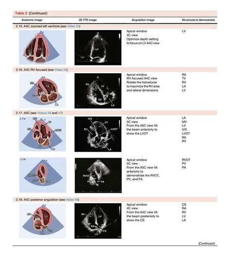 Fetal Echo Ultrasound, Cardiovascular Sonography, Cath Lab Nursing, Diagnostic Medical Sonography Student, Ultrasound School, Obstetric Ultrasound, Cardiac Sonography, Sonography Student, Ultrasound Sonography