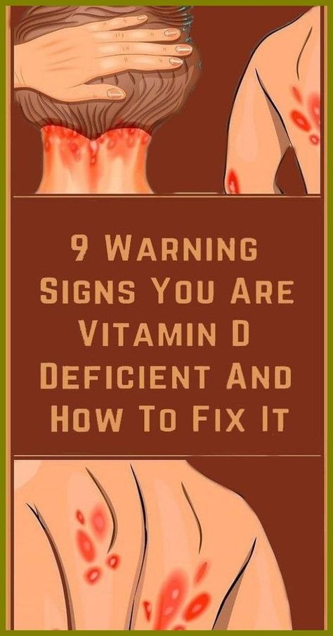 9 Signs That Could Mean You�re Not Getting Enough Vitamin D Vitamin D Deficiency Symptoms, Vitamin D Supplement, Vitamin D Deficiency, Nutrition And Dietetics, 8th Sign, Blood Test, Vitamin A, Warning Signs, Vitamin D