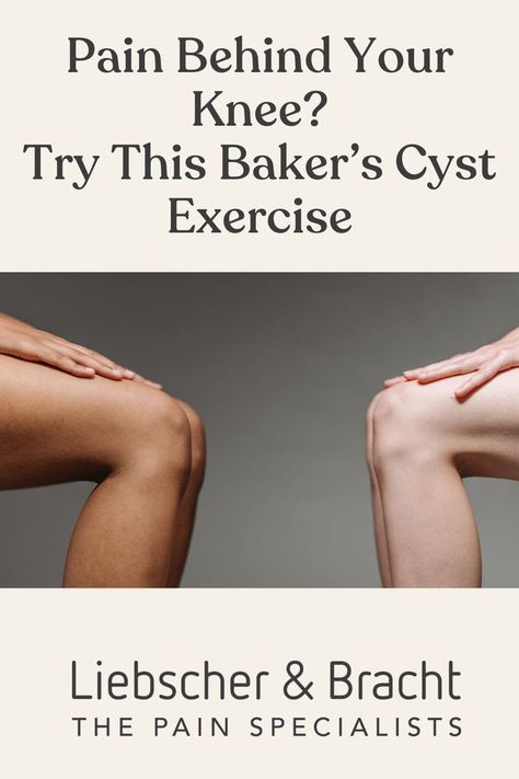 A Baker’s cyst is a fluid-filled bump that forms on the back of the knee. If you’re experiencing tightness or pain at the back of your knee because of a Baker’s cyst, this 4-minute stretching routine may help relieve your discomfort. Try now! pain behind the knee, popliteal fossa pain Fluid On The Knee, Pain Behind The Knee, Popliteal Fossa, Stretches For Knees, Knee Pain Relief Exercises, Bad Knee Workout, Knee Strengthening Exercises, How To Strengthen Knees, Stretching Routine