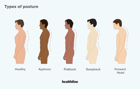 Types of Posture: How to Correct Bad Posture Types Of Posture, How To Correct Bad Posture, Perfect Posture Aesthetic, Bad Posture Reference, Good Posture Aesthetic, Forward Head Posture Correction, Correct Bad Posture, Posture Drawing, Forward Head Posture Exercises