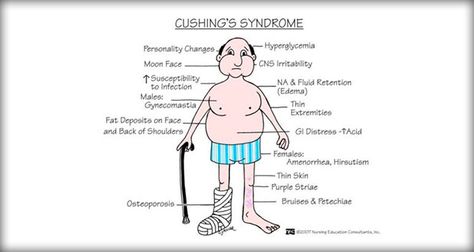 Cushing syndrome or cushing's syndrome results from excessive adrenocortical activity. Nursing care plans available here. Memory Notebook, Cushings Syndrome, Nursing Board, Nclex Prep, Nurse Manager, Nursing Mnemonics, Nursing School Survival, Nursing Life, Musculoskeletal System