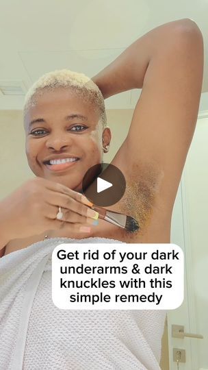 1M views · 28K reactions | Lighten your dark underarms and dark knuckles with this simple DIY home remedy | Lighten your dark underarms and dark knuckles with this simple DIY home remedy | By AngieNation | Get rid of your dark underarms and dark knuckles with this DIY home remedy I was using baking soda and lemon before it cleared oh and later came back yeah so I decided to try this method because this method is known to lighten the skin yeah to lighten that dark underarms and then your knuckles as well watch how I mix the whole thing together yeah you can apply on your knuckles the good thing is that it does not have any form of chemical so it is very safe and good for your skin I just put a little amount of paste yeah and then add your turmeric squeeze in your lemon add your honey and mi Black Knuckles Get Rid Of, How To Clear Dark Knuckles, Dark Knuckles Remedies How To Get Rid, How To Remove Dark Knuckles, Dark Knuckles Remedies, How To Get Rid Of Dark Knuckles, How To Get Rid Of Dark Underarms, Dark Knuckles, Baking Soda For Dandruff