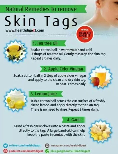 Never knew that... What Are Skin Tags, Apple Cider Vinegar Lemon, Remove Skin Tags, Remove Skin Tags Naturally, Skin Tags, Glow Skin, Oil Benefits, Natural Medicine, Tree Oil