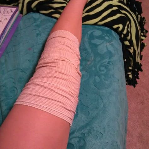 Fell off my bike got my leg hurt bruses and scawers and lip and eye swallon i fell off of it preety hard Leg Fracture Snapchat, Leg Bandage Snapchat, Broke Leg Snapchat, Makeup Collection Goals, Eating Food Funny, Shower Pics, Leg Injury, Pretty Pens, Hand Photo