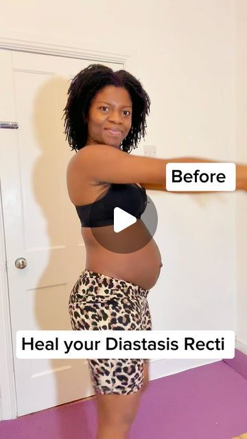 Chioma Eva Iloduba | Your Tummy Fat Loss Coach on Instagram: "If your mummy tummy refuses to go, what you have is called Diastasis Recti? 

Strengthen your core  with these targeted exercises! 

These safe and effective movements are designed to heal and restore your abdominal muscles. 

Remember to take it slow at the beginning and focus on mind to muscle connection . Consistency is key!

For accountability and training join my TTT group program @get_fitt_with_eva 

#DiastasisRecti #PostpartumRecovery #CoreExercises #StrongCore #HealingJourney #FitnessForMoms #PostpartumFitness #AbWorkout #MomLife #HealthAndWellness #FitnessJourney #NewMom #PelvicFloorHealth #WorkoutRoutine #SelfCare #BodyPositive #StrongMoms #MomStrengtht" Mummy Tummy Workout, Targeted Exercises, Simple Workout Routine, Simple Workout, Mummy Tummy, Diastasis Recti Exercises, Mommy Tummy, Take It Slow, Strengthen Your Core