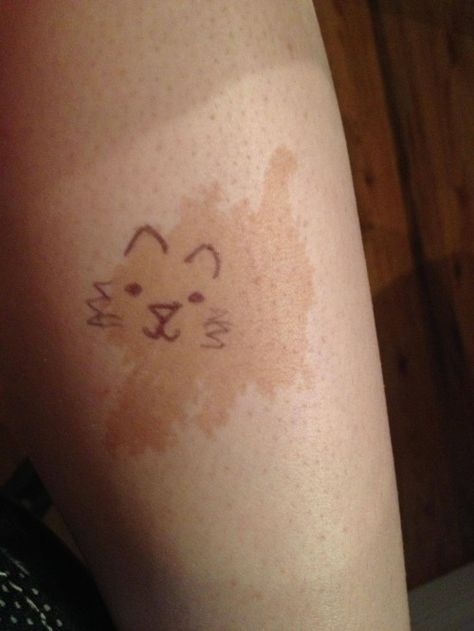 Birthmark Tattoo, Birth Marks, Cat Tatto, Mark Tattoo, Mom Activities, Wine Stains, Weird Tattoos, Bad Tattoos, Natural Cat