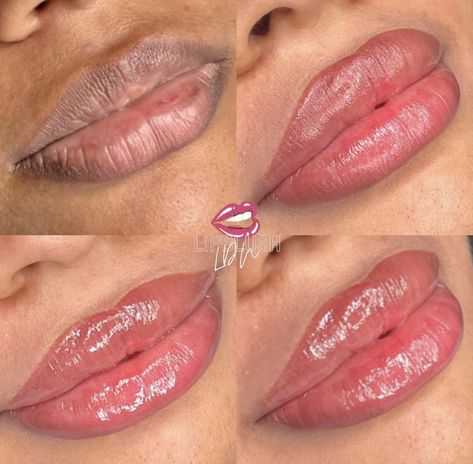 Lip Blush Black Women, Lip Filler Before And After Black Women, Blush Black Women, Lip Combos, Makeup Inspired, Lip Blush, Lip Filler, Lip Fillers, Lip Colour