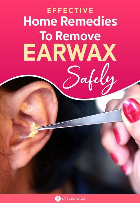 Natural Ear Wax Removal, Clean Ear Wax Out, Unclog Ears, Ear Cleaning Wax, Clogged Ears, Ear Wax Buildup, Cleaning Your Ears, Toxic Waste, Ear Canal