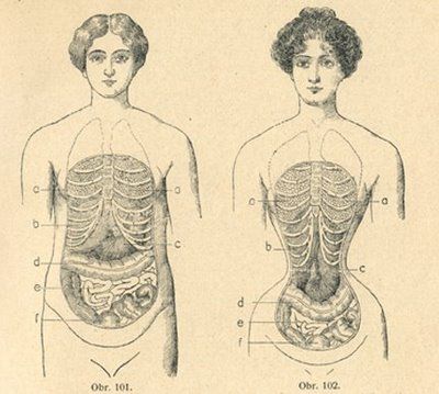 Wasp waist. Image from Nové Domácí Léčení, date unknown.Goal is 18 inch waist. Wasp Fashion, Womens Anatomy, Anatomical Drawings, Wasp Waist, Class Presentation, Gross Anatomy, Body Diagram, Old Photography, Vintage Medical