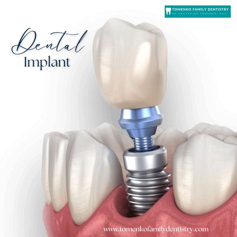 Our office is here to help you! We offer high quality dental implant procedure to help restore your smile. 
Contact us today to learn how dental implants can benefit you.
📲 301-439-8333 Dental Post, Dentist Ideas, Bionic Man, Dental Advertising, Dental Photos, Cosmetic Dentistry Procedures, Dental Implant Procedure, Dental Posts, Teeth Dentist