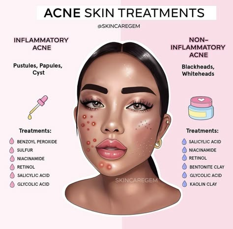 Haut Routine, Skin Advice, Skin Care Routine Order, Basic Skin Care, Acne Treatments, Basic Skin Care Routine, Clear Skin Tips, Perfect Skin Care Routine, Acne Solutions